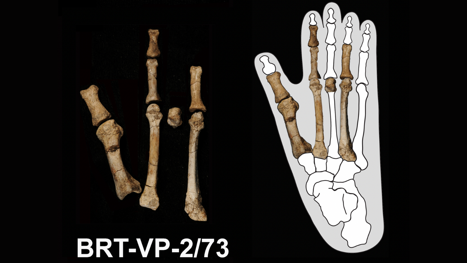 Clues To Sex Revealed In Foot Bones Live Science Clues To Sex Revealed In Foot Bones Live Science