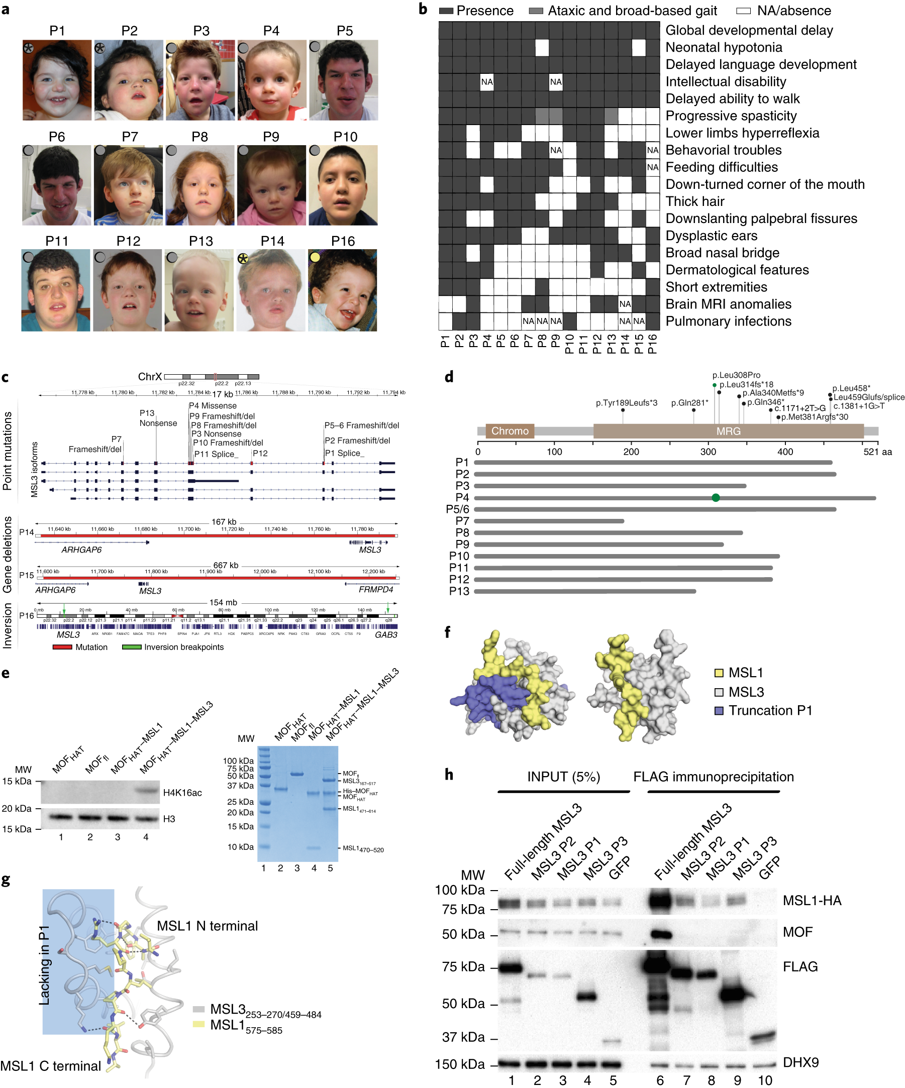 De Novo Mutations In MSL3 Cause An X linked Syndrome Marked By Impaired Histone H4 Lysine 16 Acetylation Nature Genetics De Novo Mutations In MSL3 Cause An X linked Syndrome Marked By Impaired Histone H4 Lysine 16 Acetylation Nature Genetics